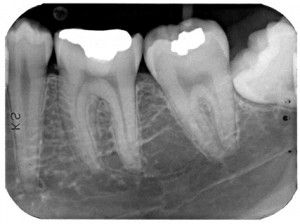 x-ray