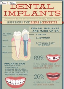 implantinfo